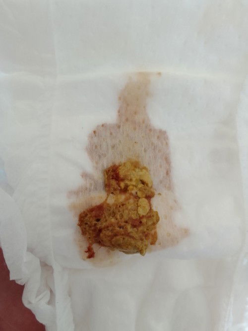 ลูกอึมีเลือด