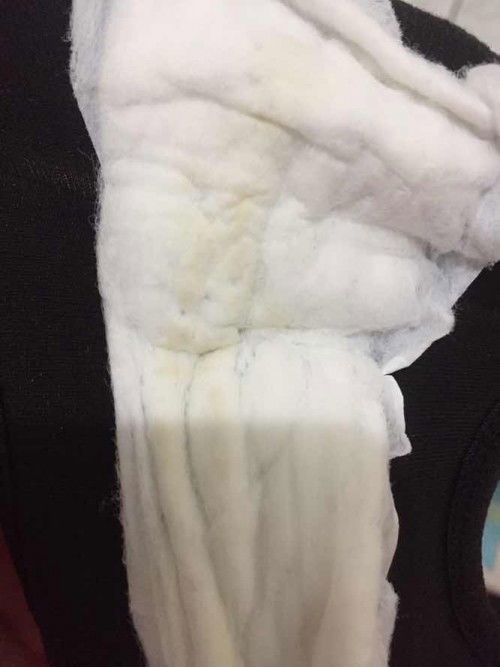 keputihan wajar atau tidak