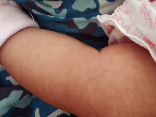 Patsi patsi skin ni baby