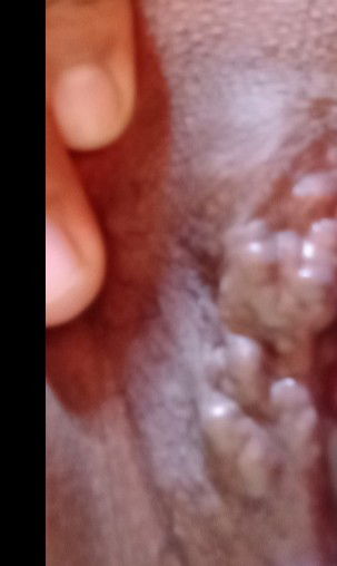 Mga mommies nakaranas din ba kayo ng ganito sa inyong pag bubuntis ? ano po ito? sana ma sagot 😢