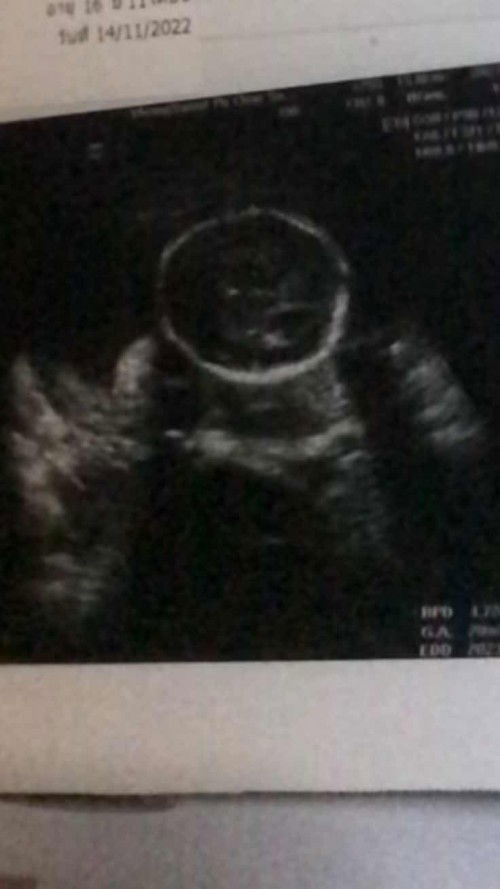 คืออะไรหรอคะดูไม่ออกเลยค่ะ