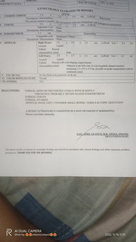 TVS RESULT