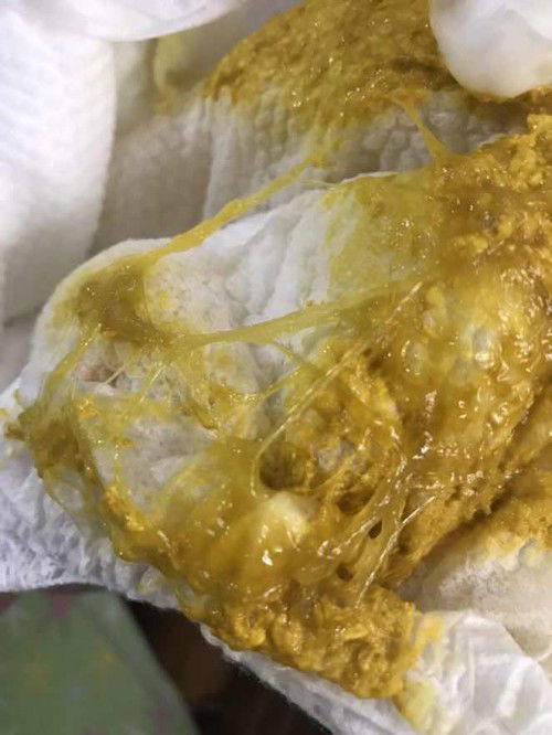 sipon ba ito mga mamsh