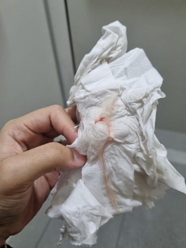 DISCHARGE WITH BLOOD! PREGNANCY 15 WEEKS