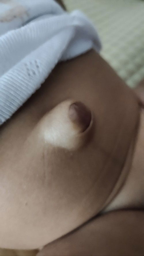 Adakah yang pusar anaknya seperti ini?