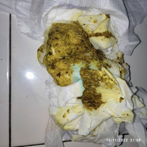 Najis bayi 5 bulan seperti ini normal kah?