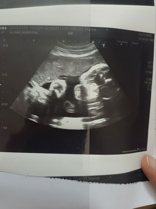 ผู้หญิงหรือผู้ชาย