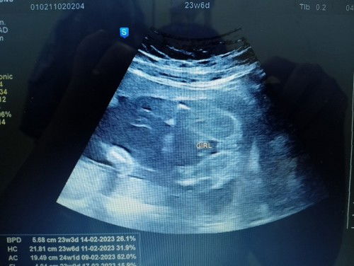 Agak2 mummy ni boy / girl. Saje nak kan kepastian 🤗 Tq yg sudi jawab 🤗