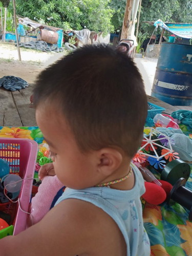 ลูกอายุ7เดือนหัวแบนยังพอมีวิธีแก้ได้ไหมคะ