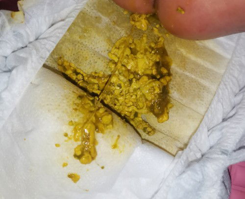 Normal po ba itong poop ni baby?