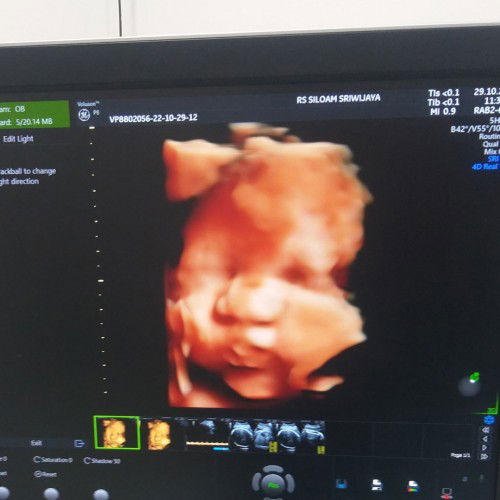 Minta doanya bun semoga dedek segera launching, HPL awal desember.