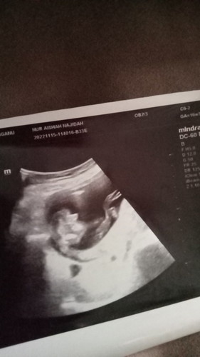 Pic Jantina baby