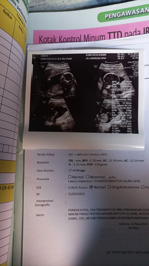 Plasenta menutupi jalan lahir usia kandungan 17  weeks, ga ada flek itu bahaya ga ya??