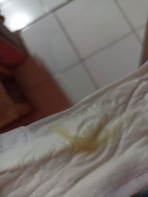 Tadi siang pas mau mandi ada flek begini apakah aman bun? Usia kehamilan 5 minggu bunda