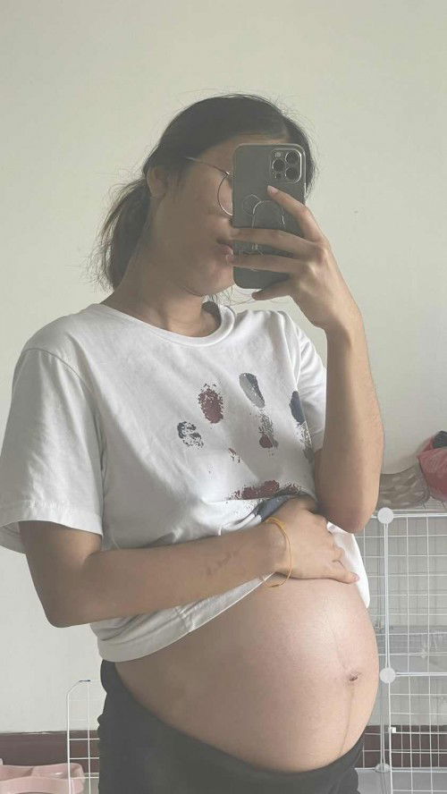 ท้องน้องแฝด26+4weeks ท้องเราเล็กไปมั้ยคะ?