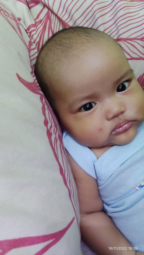 Bayi 4 bulan bisa kuning