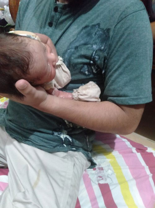 Bayi kurang 1 bulan muntah