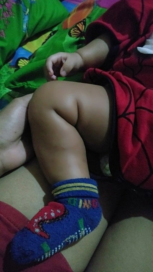 Lipatan kaki bayi tanda klau punya adik prempuan