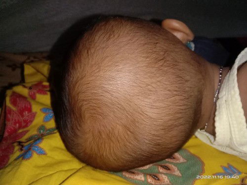 Belom lebat rambutnya