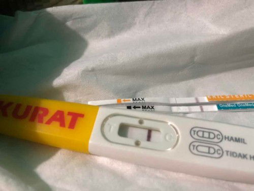 Ada yang sama punya kelainan uterus arcuata? (Penantian 5tahun)