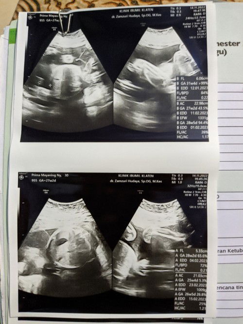 Inspirasi Nama untuk Bayi Kembar Perempuan dong Bunda 🥰