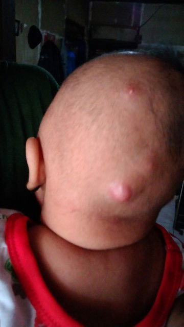 MOHON INFO NYA YG TAU PENYAKIT INI BUN?