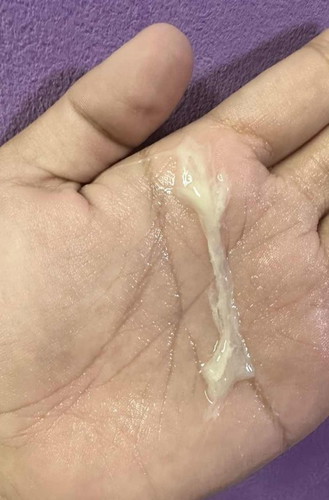 keputihan/mucus plug