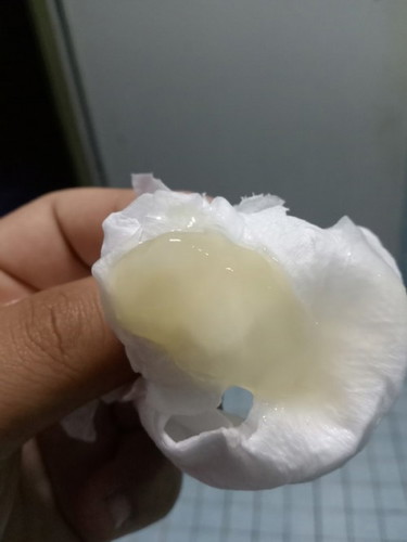 มีมูกสีแบบนี้ออกมาแล้วปวดหน่วงๆ คือสัญญาณจะคลอดหรือป่าวค่ะ38+1วีค
##ขอบคุณล่วงหน้านะคะ