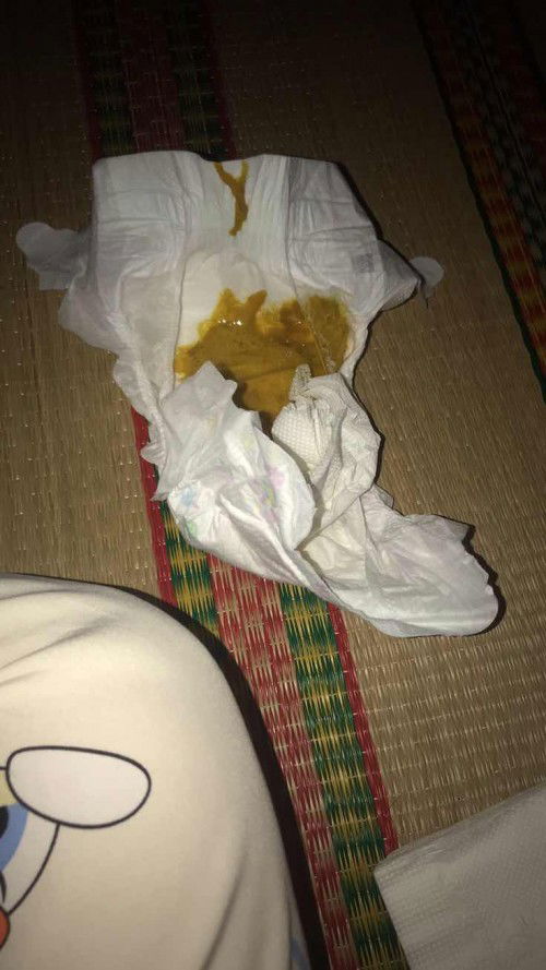 Bé nhà e 2m17d đi ngoài như vầy là có sao không các m , bé đi suốt tuần nay r ạ