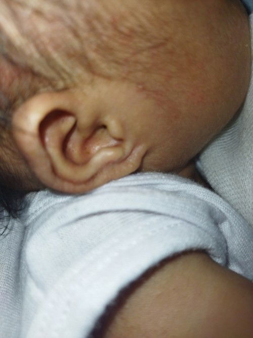 Hi mga mii ask ko lng ano po bang pdeng ilagay s tenga ng baby ko Magaspang po sya salamat po