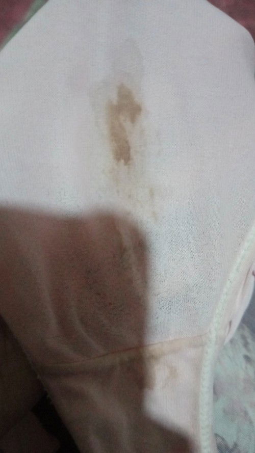 Bu ada pengalaman sama sptri saya
Jawan bun🙏