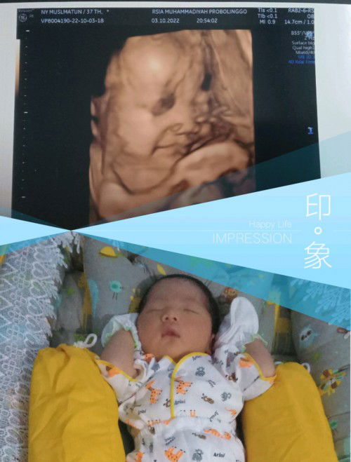 Hpl sesuai hpht 03 Desember, sesuai USG 20 November tapi launching 11/11/2022 11:00