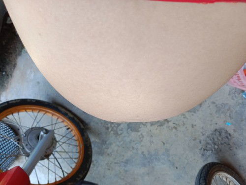 อาการอะไร อันตรายหรือไม่?