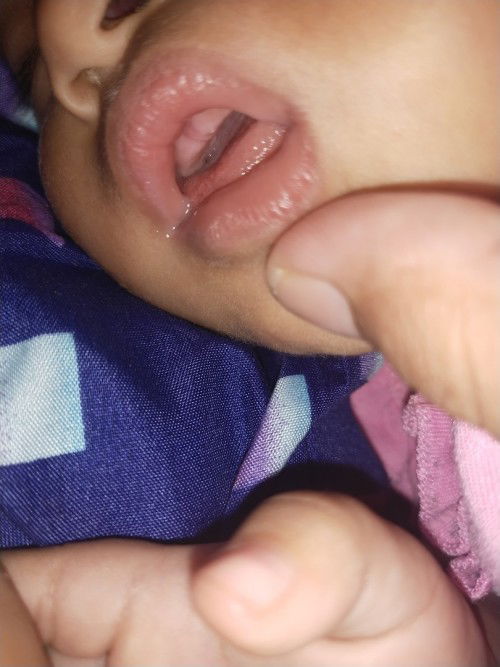 Apakah Ini Tumgi ya ?