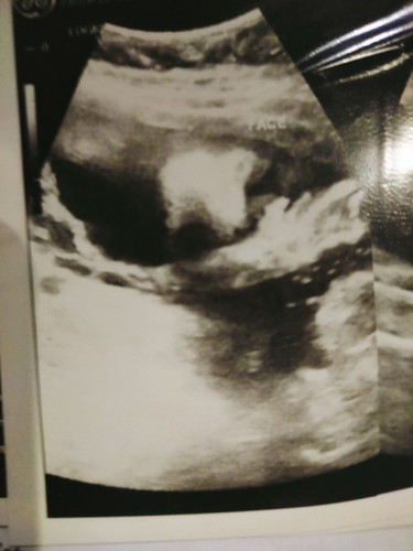 face ni baby