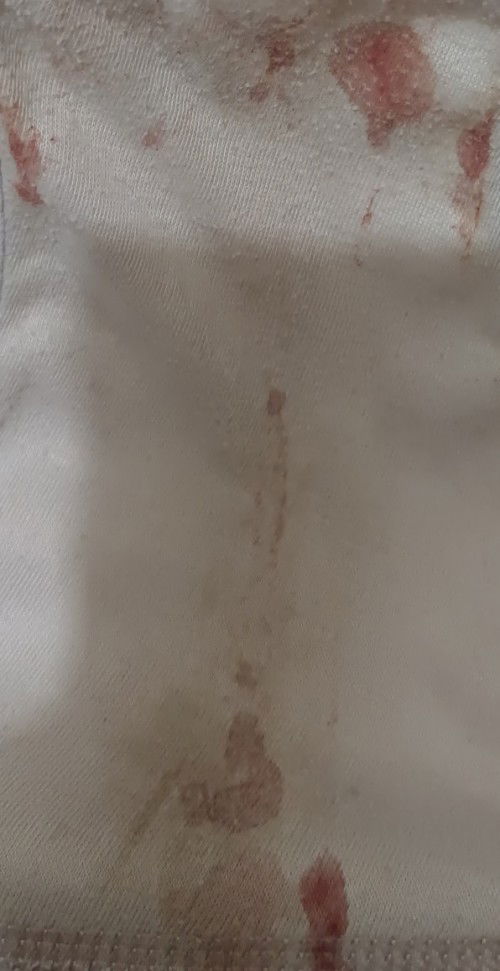 Flek di kehamilan 5 minggu