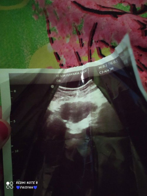 Bismillah
Adakah yang sama? Saya hpht 24 September sudah ngerasain tanda hamil