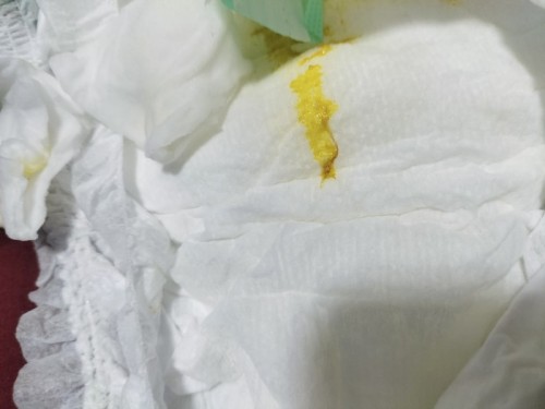 น้อง2เดือนอึเป็นมมูกเลือดค่ะ