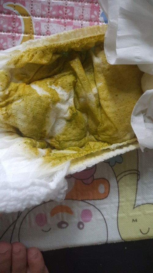 Bun maaf mau tanya apakah fases bayi seperti ini termasuk diare??bayiku baru 5 hari mpasi