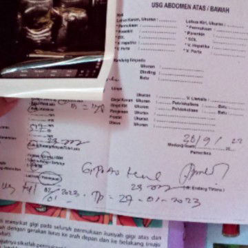 kira² skrg brppa wek ya di usg kemaren tgl 30sep 23wek