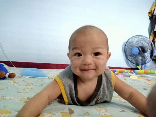 สอบถามหน่อยค่ะ พอดีน้องเป็นผื่น