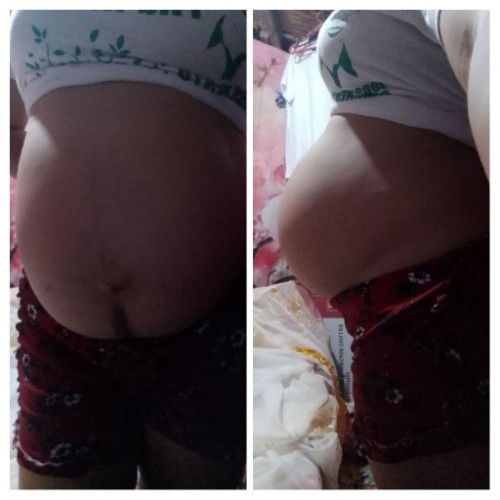 Mga mommies Tanong lng Po ma baba n Po ba tummy ko current 36 weeks 3 days 🙂