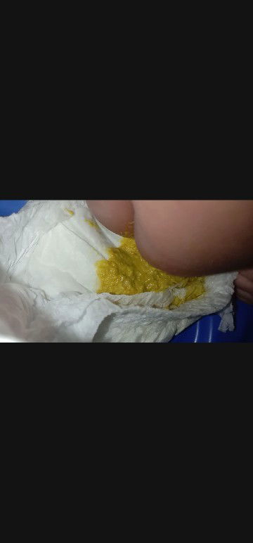 ถ่ายแบบนี้ปกติไหมคะ 1เดือน9วัน