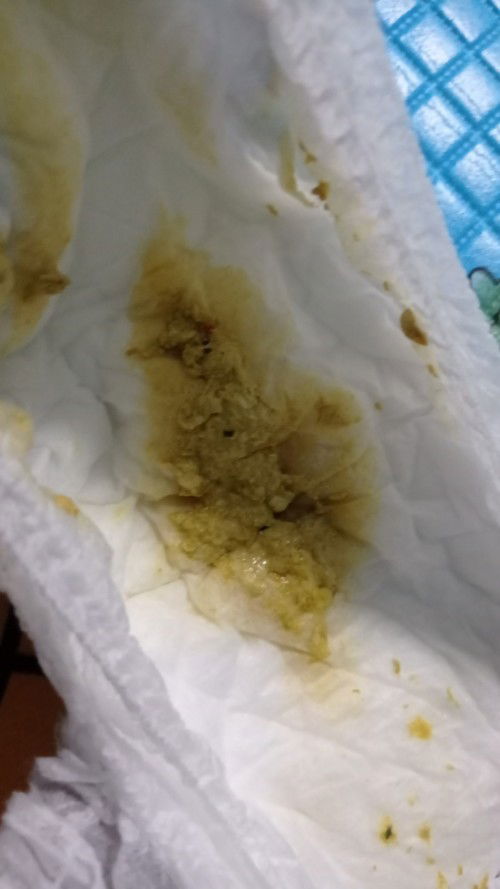 Diare pada bayi 6 bulan