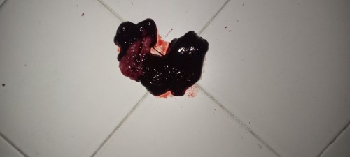 ขอถามแม่ๆหน่อยนะคะ