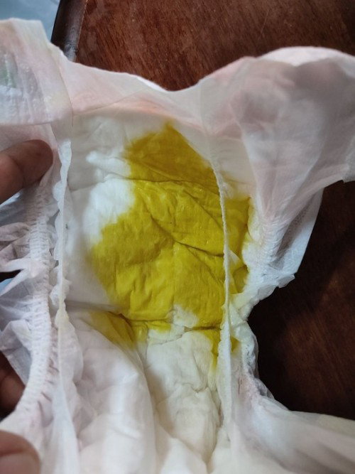 Kekerapan bayi berak