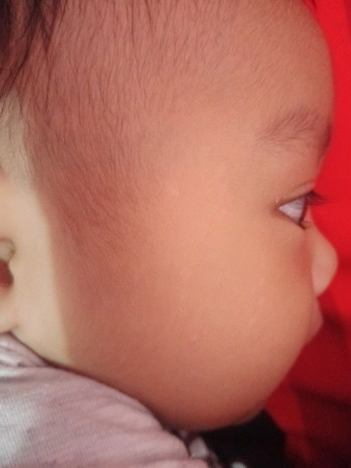 Bercak putih warna putih dimuka