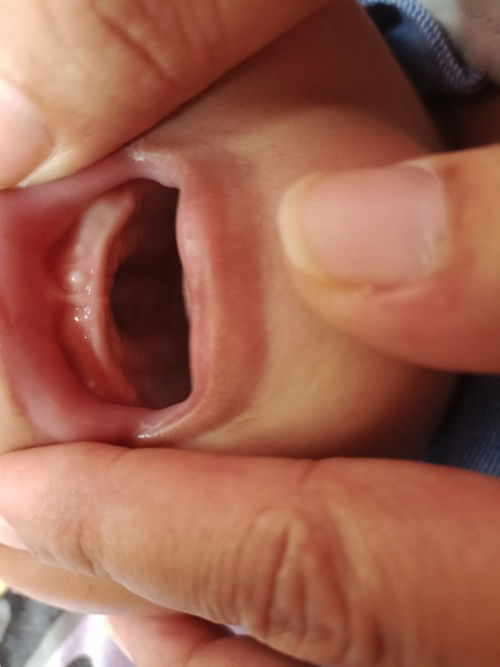 tumbuh gigi emg kaya gini ya