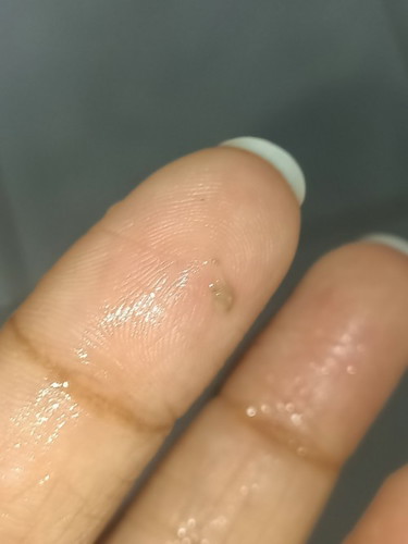 Keluar lendir masa kencing