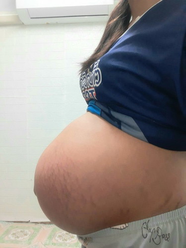 34w5yแล้ว ปวดหลังมากแถมเจ็บจิมิอีก🥺🤣